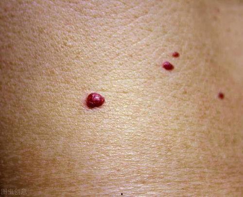 吃瓜爆料有颗痣,明星身上那颗痣，竟隐藏着惊人秘密！